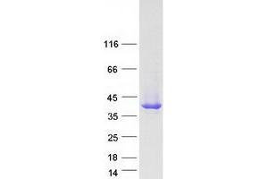 Validation with Western Blot