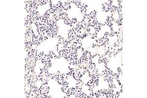 Immunohistochemistry analysis of paraffin-embedded rat lung using,GTF2F2 (ABIN7074036) at dilution of 1: 3000