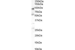Image no. 1 for anti-Oxysterol Binding Protein-Like 10 (OSBPL10) (Internal Region) antibody (ABIN374621) (OSBPL10 anticorps  (Internal Region))