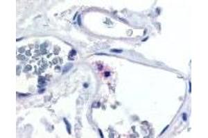 Immunohistochemistry (IHC) image for anti-Integrin, alpha X (Complement Component 3 Receptor 4 Subunit) (ITGAX) (Internal Region) antibody (ABIN2469521)