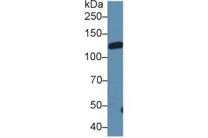 Western blot analysis of Rat Serum, using Rat LIFR Antibody (1 µg/ml) and HRP-conjugated Goat Anti-Rabbit antibody ( (LIFR anticorps  (AA 152-291))