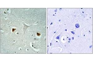 Immunohistochemistry analysis of paraffin-embedded human brain tissue, using STAT3 (Ab-727) Antibody. (STAT3 anticorps  (AA 694-743))