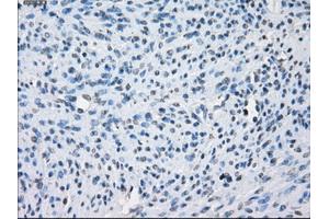 Immunohistochemical staining of paraffin-embedded colon tissue using anti-AURKCmouse monoclonal antibody. (Aurora Kinase C anticorps)