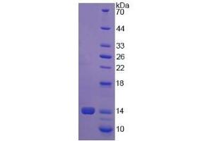 Image no. 1 for Procollagen-Lysine,2-Oxoglutarate 5-Dioxygenase 1 (PLOD1) (AA 636-727) protein (His tag) (ABIN4990200)