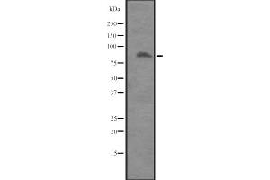Western blot analysis of ITGB8 expression in Placenta lysate ,The lane on the left is treated with the antigen-specific peptide. (ITGB8 anticorps  (Internal Region))