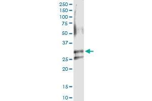Immunoprecipitation of ARHGDIA transfected lysate using anti-ARHGDIA MaxPab rabbit polyclonal antibody and Protein A Magnetic Bead , and immunoblotted with ARHGDIA purified MaxPab mouse polyclonal antibody (B02P) .