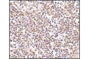 Immunohistochemistry of lipe in human lymph node tissue with this product at 2. (LIPE anticorps  (C-Term))