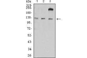 Western blot analysis using CD11a mouse mAb against HL-60 (1), A549 (2), and SW620 (3) cell lysate. (ITGAL anticorps  (AA 26-194))