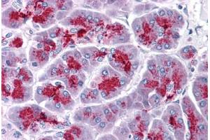 Human Pancreas: Formalin-Fixed, Paraffin-Embedded (FFPE) (ELOVL7 anticorps  (N-Term))