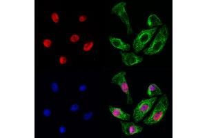 ABIN6260310 and ABIN6272938 staining Hela cells by IF/ICC. (BRD7 anticorps  (Internal Region))