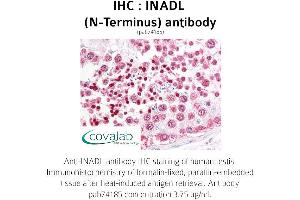 Image no. 1 for anti-InaD-Like (INADL) (N-Term) antibody (ABIN1735910) (PATJ anticorps  (N-Term))
