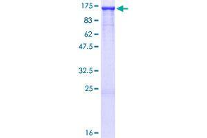 Image no. 1 for Huntingtin Interacting Protein 1 (HIP1) (AA 1-1037) protein (GST tag) (ABIN1306634)