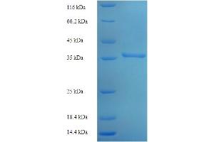 SDS-PAGE (SDS) image for Adenylate Kinase 1 (AK1) (AA 1-194), (full length) protein (His-SUMO Tag) (ABIN5709027)