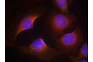Immunofluorescence staining of methanol-fixed Hela cells using CDK6(phospho-Tyr13) Antibody. (CDK6 anticorps  (pTyr13))