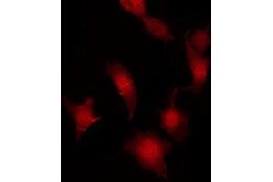 ABIN6267032 staining Hela by IF/ICC.