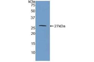 Detection of Recombinant MAOA, Mouse using Polyclonal Antibody to Monoamine Oxidase A (MAOA) (Monoamine Oxidase A anticorps  (AA 229-428))