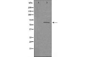 Western blot analysis of extracts from COLO cells using SLC22A3 antibody. (SLC22A3 anticorps  (Internal Region))
