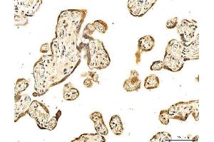 IHC analysis of 53BP1/TP53BP1 using anti-53BP1/TP53BP1 antibody (ABIN7599869). (TP53BP1 anticorps  (AA 1239-1972))