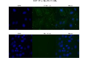 Sample Type :  SKOV3   Primary Antibody Dilution:  4 ug/ml   Secondary Antibody :  Anti-rabbit Alexa 546   Secondary Antibody Dilution:  2 ug/ml   Gene Name :  CSTF2T