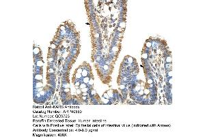 Rabbit Anti-KARS Antibody  Paraffin Embedded Tissue: Human Intestine Cellular Data: Epithelial cells of intestinal villas Antibody Concentration: 4. (KARS anticorps  (C-Term))