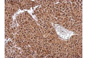 Image no. 2 for anti-Density-Regulated Protein (DENR) (AA 1-198) antibody (ABIN1501885)