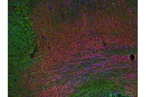 Indirect immunostaining of PFA fixed section of triangular nucleus of septum with anti-EPS 8 (dilution 1 : 200; red) and mouse anti-α-tubulin (cat. (EPS8 anticorps)