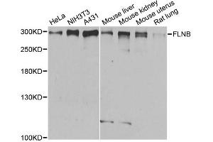 Western blot analysis of extracts of various cell lines, using FLNB antibody. (FLNB anticorps)
