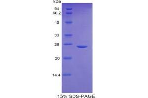SDS-PAGE analysis of Mouse GCLC Protein. (GCLC Protéine)