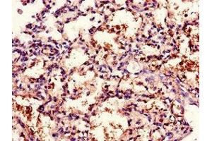 Immunohistochemistry of paraffin-embedded human lung tissue using ABIN7171408 at dilution of 1:100 (CD96 anticorps  (AA 306-395))
