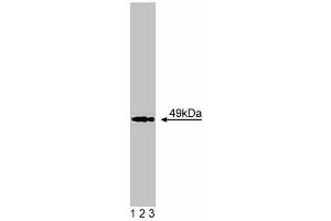 Western blot analysis of Acetylcholine Receptor alpha on BC3H1 lysate. (CHRNA1 anticorps  (AA 332-457))