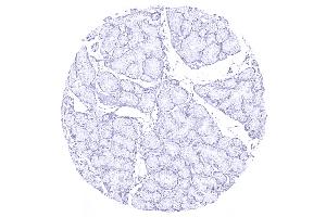 Duodenum Brunner gland