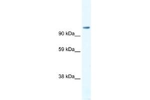 WB Suggested Anti-FOXP4 Antibody Titration:  1. (FOXP4 anticorps  (C-Term))