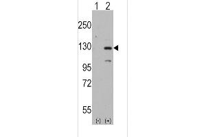 Western blot analysis of DM1 (arrow) using rabbit polyclonal DM1 Antibody (Human N-term) (ABIN389179 and ABIN2839342). (DAAM1 anticorps  (N-Term))