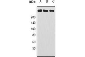 Western blot analysis of CAD expression in HepG2 (A), Hela (B), HL60 (C) whole cell lysates. (CAD anticorps)