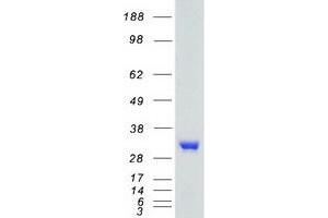Validation with Western Blot