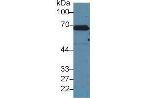 Detection of CK2 in Human A431 cell lysate using Polyclonal Antibody to Keratin 2 (CK2) (Keratin 2 anticorps  (AA 508-685))
