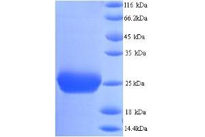 SDS-PAGE (SDS) image for Thrombospondin 2 (THBS2) (AA 19-232), (partial) protein (His tag) (ABIN5713892)