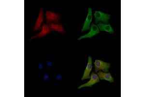 Phospho-Rab3A (Thr86) Antibody staining Hela cells(heat shock treatment) by IF/ICC.