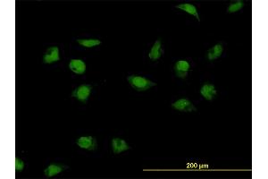 Immunofluorescence of monoclonal antibody to CNOT3 on HeLa cell. (CNOT3 anticorps  (AA 1-100))