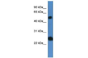 WB Suggested Anti-SLA2 Antibody Titration: 0.