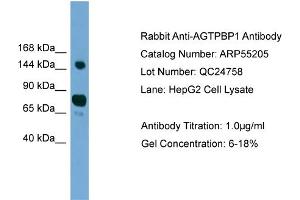 WB Suggested Anti-AGTPBP1  Antibody Titration: 0. (AGTPBP1 anticorps  (N-Term))
