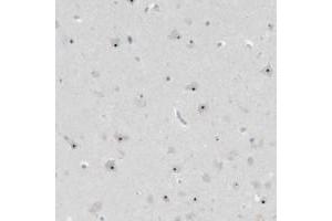 Immunohistochemical staining of human hippocampus with BXDC5 polyclonal antibody  shows distinct nucleolar positivity in neuronal cells. (RPF1 anticorps)