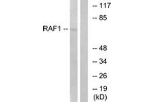 Western blot analysis of extracts from HeLa cells, treated with UV 5', using C-RAF (Ab-621) Antibody. (RAF1 anticorps  (AA 591-640))