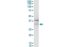 PIH1D1 MaxPab polyclonal antibody.