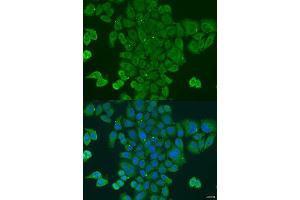 Immunofluorescence analysis of U2OS cells using DPM1 antibody. (DPM1 anticorps  (AA 1-260))