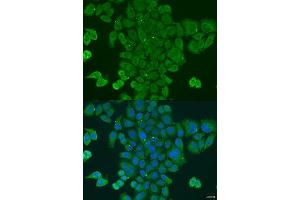 Immunofluorescence analysis of U2OS cells using DPM1 antibody. (DPM1 anticorps  (AA 1-260))