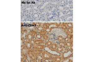 Immunohistochemistry (IHC) image for anti-Cadherin 1, Type 1, E-Cadherin (Epithelial) (CDH1) antibody (ABIN6254215)