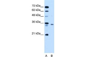 WB Suggested Anti-RCE1 Antibody Titration:  1. (RCE1/FACE2 anticorps  (N-Term))
