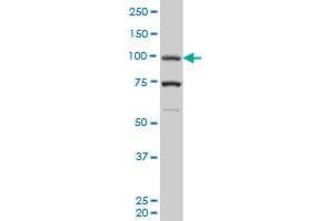 PGR monoclonal antibody (M05), clone 1B11 Western Blot analysis of PGR expression in K-562 . (Progesterone Receptor anticorps  (AA 1-110))