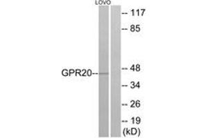 Western blot analysis of extracts from LOVO cells, using GPR20 Antibody. (GPR20 anticorps  (AA 291-340))